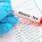 malaria - test